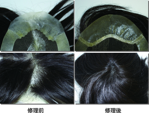 修理事例：生え際の人工皮膚劣化と増毛